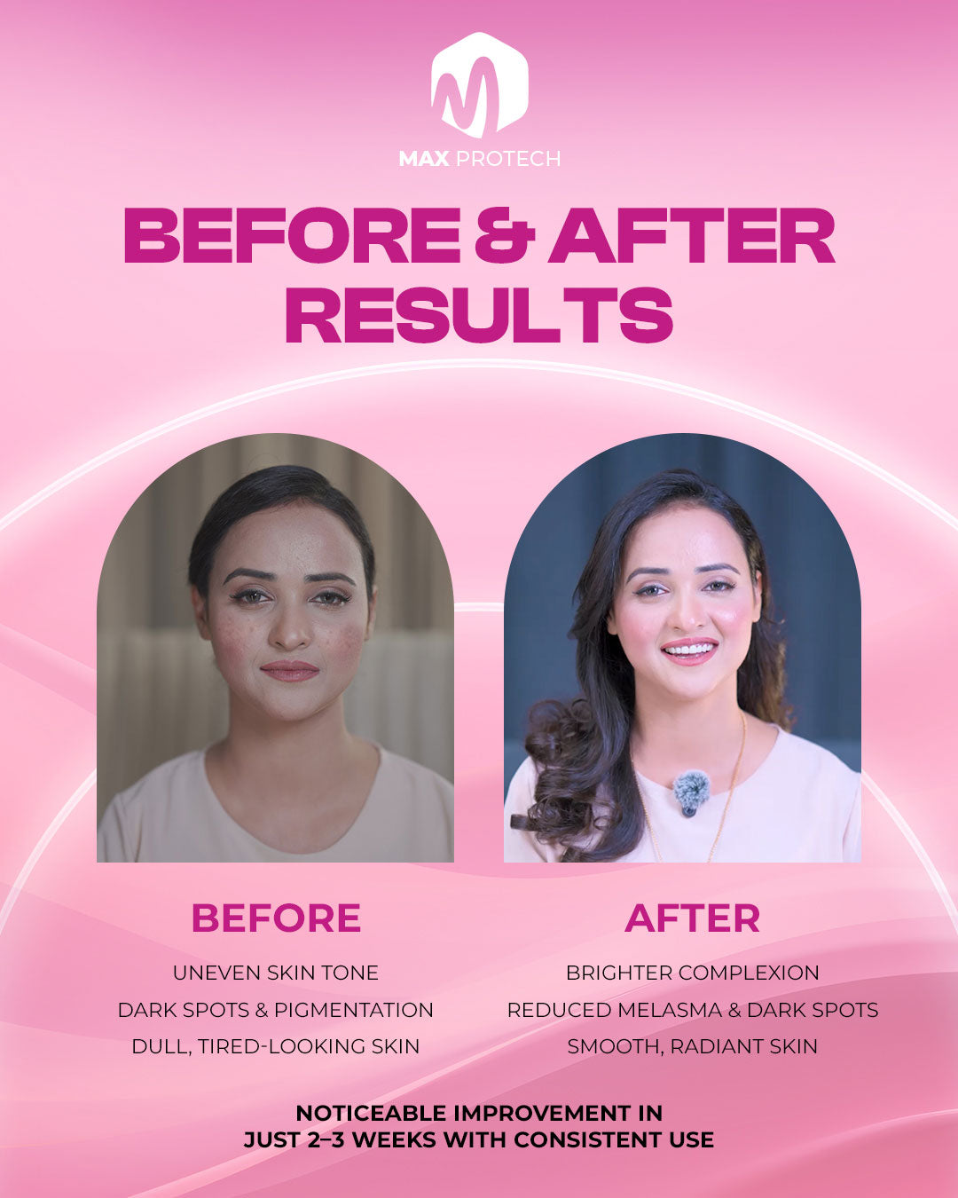 Mela Lite Whitening Cream