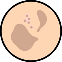 Pigmentation
