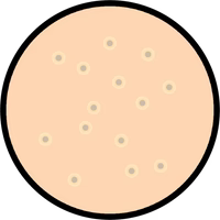 Pores